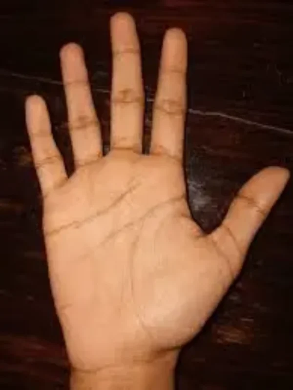 effects of no fate line on palm